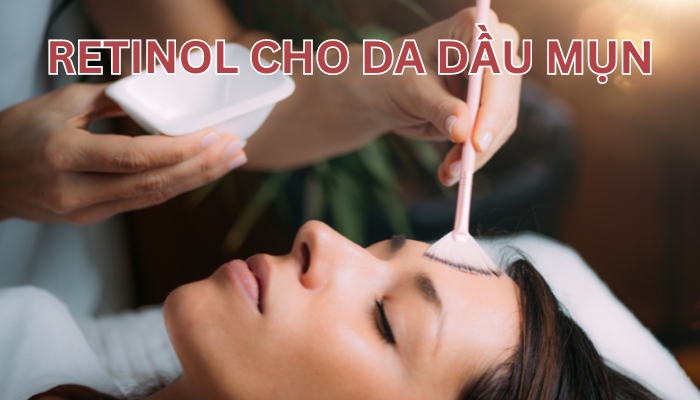 retinol cho da dầu mụn