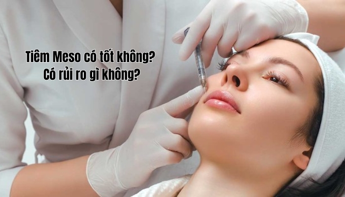 Tiêm meso có tốt không? Có rủi ro gì không?